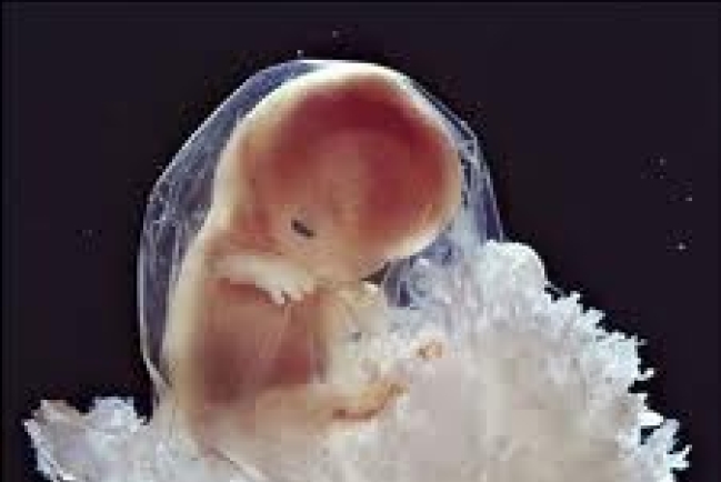 陳盧美馨：「人」在加國法例中的定義