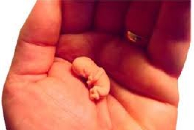 法國政府或為墮胎費用買單