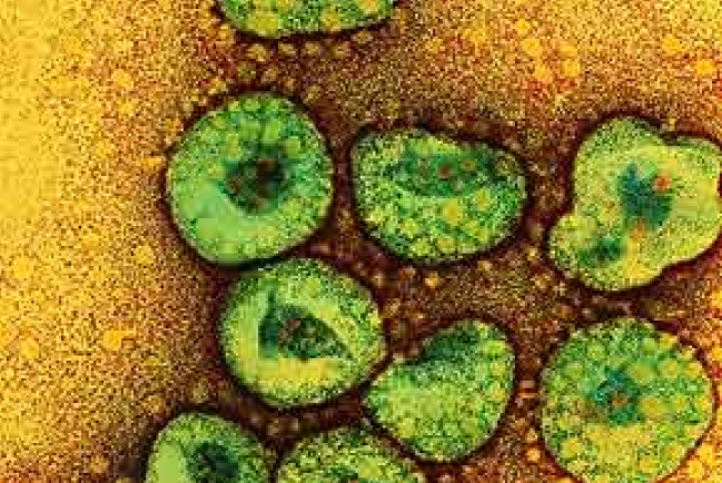 法國新沙士人傳人世衞籲關注