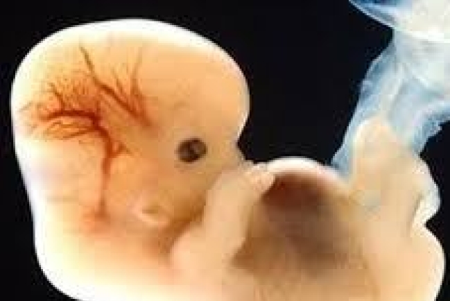 「自選性別」具爭議 先天雙性兒又如何﹖