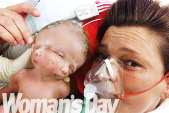 誕「信」和「望」 連體嬰母親感謝上帝禮物