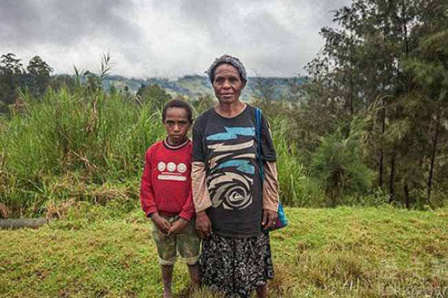 巴布亞新幾內亞美宣教士救人被燒傷