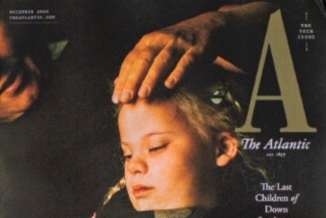 丹麥打掉唐氏症胎兒推崇優生？ 文化期刊報導掀爭議