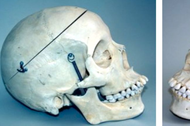 遺骸都有跨性別？ 考古學界掀爭議