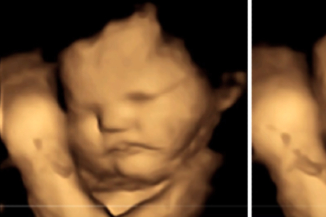 子宮嬰兒有沒有生命？3D超聲波圖片揭開秘密