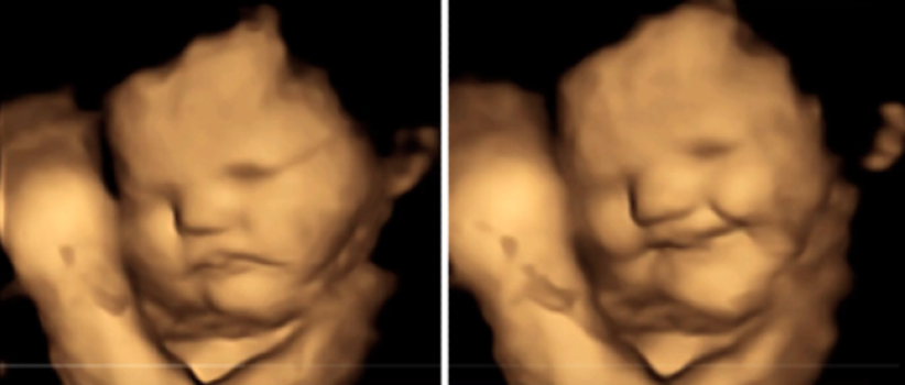 子宫婴儿有没有生命？3D超声波图片揭开秘密 