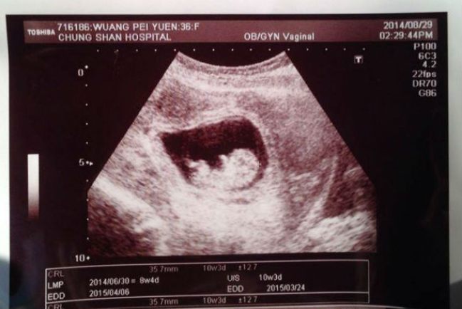 劉畊宏王婉霏懷第三胎 稱上帝所賜超乎所求