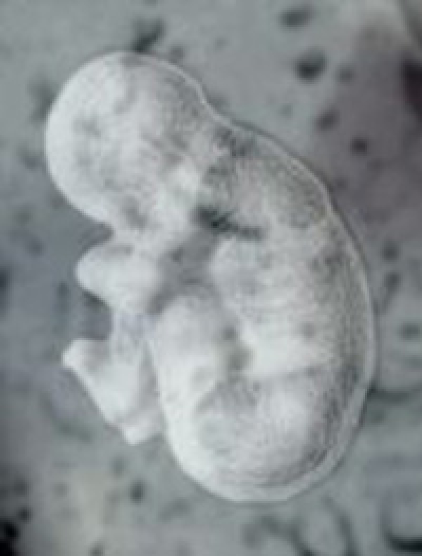 聯合國委員會通過 禁止各種形式複製人研究