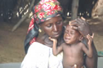 非洲尼日爾80萬兒童陷於糧荒