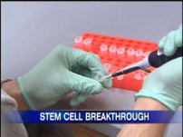 幹細胞研究新突破 有望解決道德爭議
