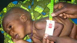 西非糧食危機告急  1500萬人缺糧