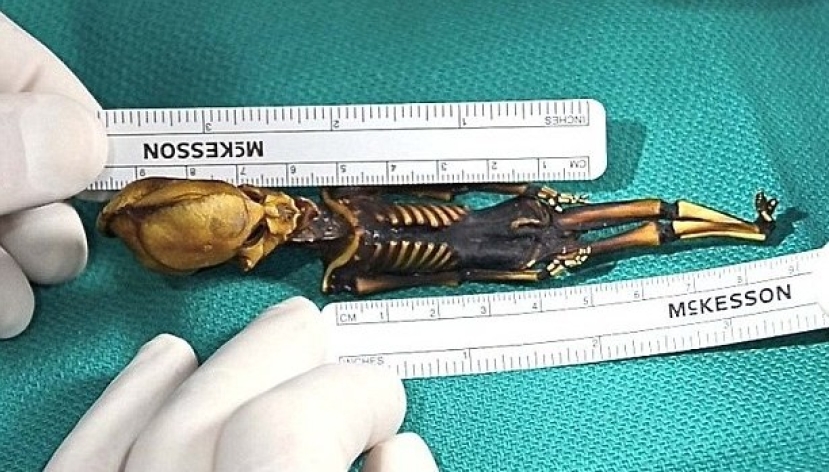 纪录片《天狼星》为迷你