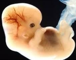 「自選性別」具爭議 先天雙性兒又如何﹖