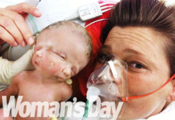 誕「信」和「望」 連體嬰母親感謝上帝禮物